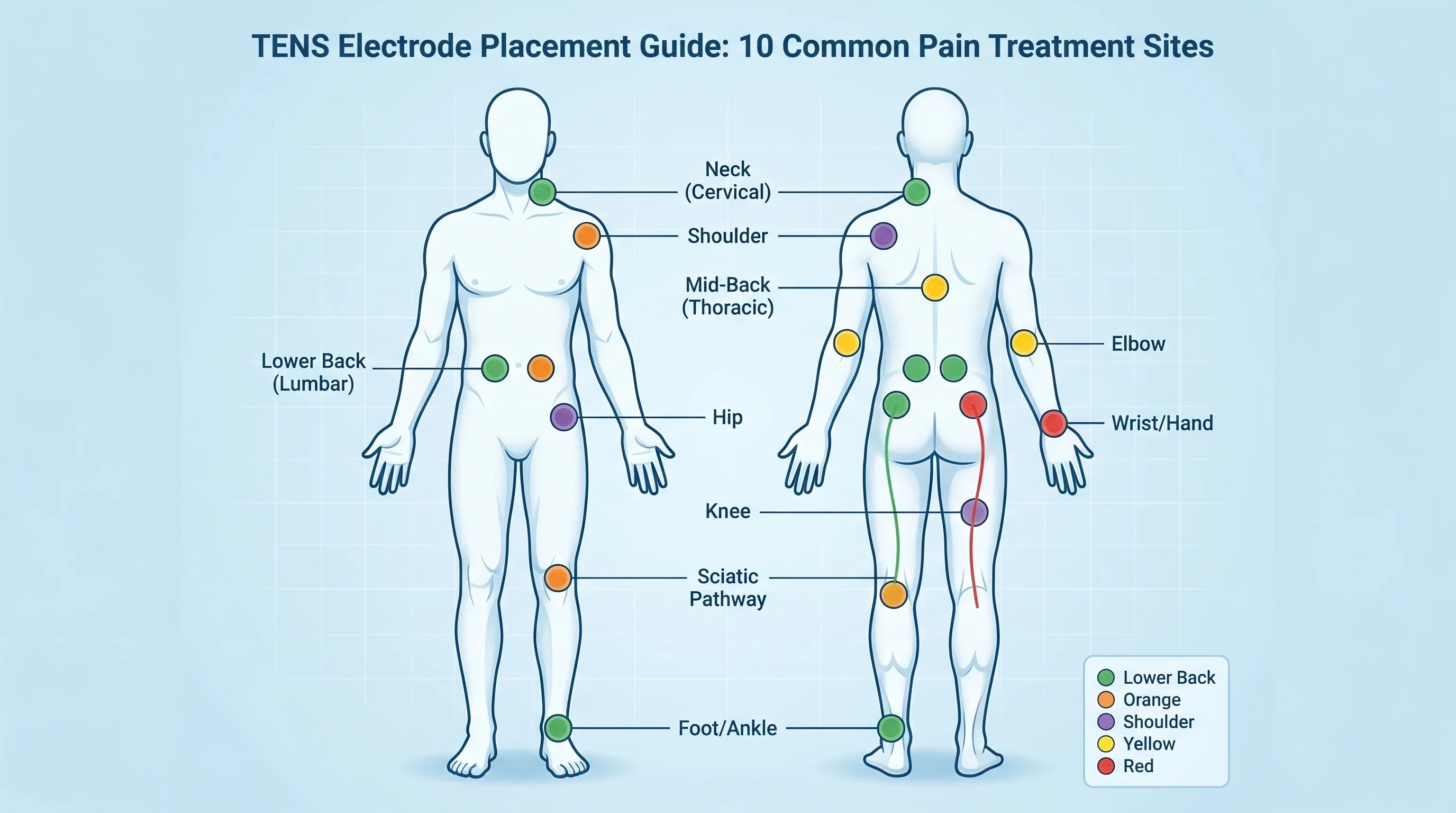 Full Body TENS Electrode Placement Reference: 10 Common Treatment Sites